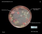 MacConkey agar